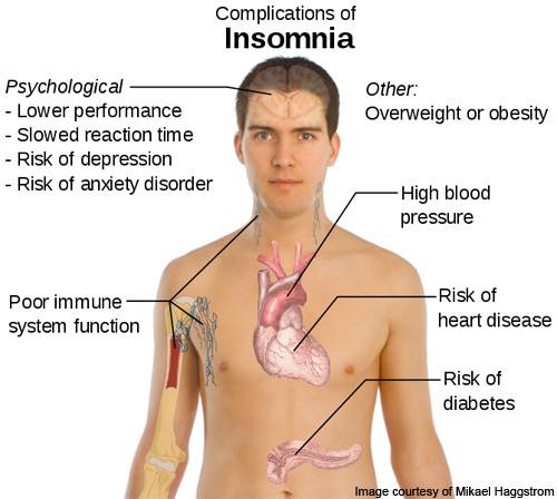 Effects of Insomnia